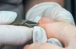 Medical Pedicure Canberra